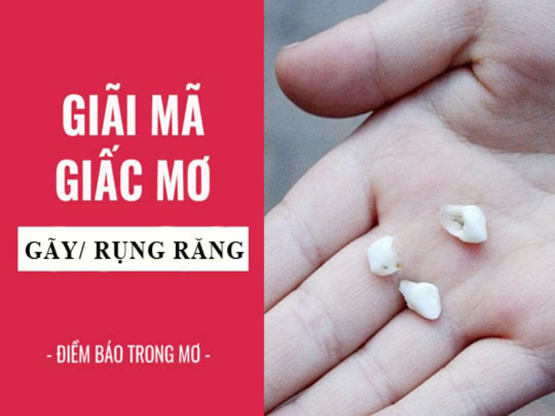 Nguyên nhân dẫn đến việc nằm mơ thấy răng rụng